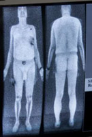 Body scanner, al via i test in Italia